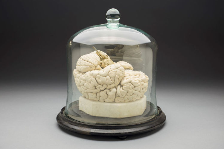 Picture of Brain Medical Model