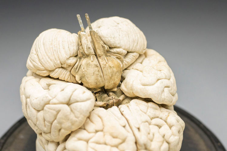 Picture of Brain Medical Model