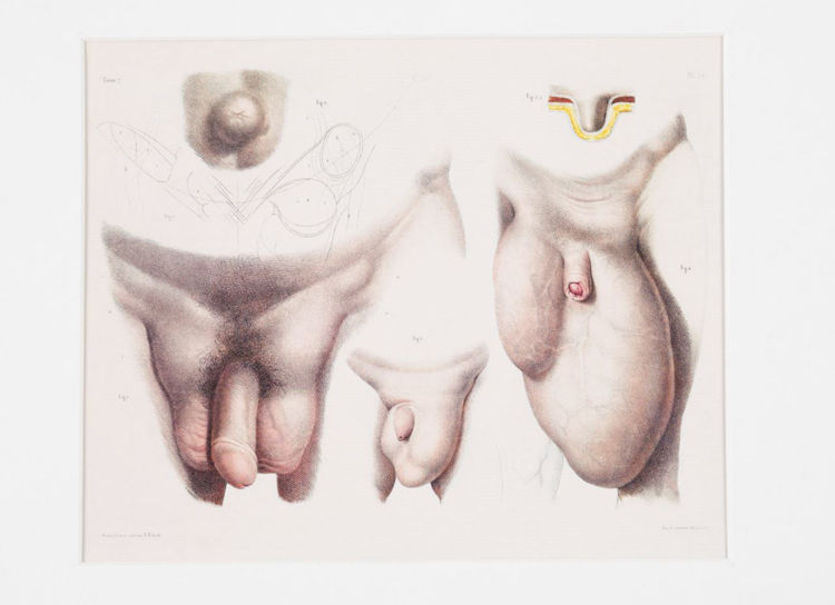 Picture of Medical Reproductive Anatomy Drawing